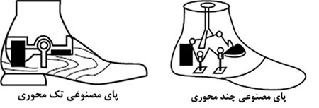 پروتز پای تک محوری و چندمحوری