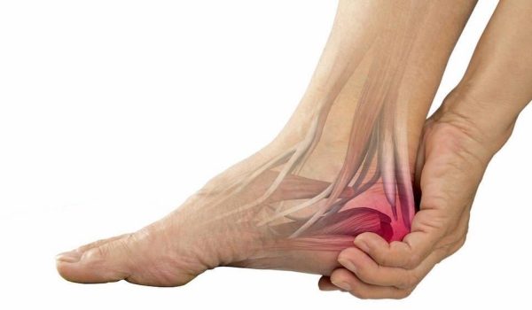 درمان خار پاشنه