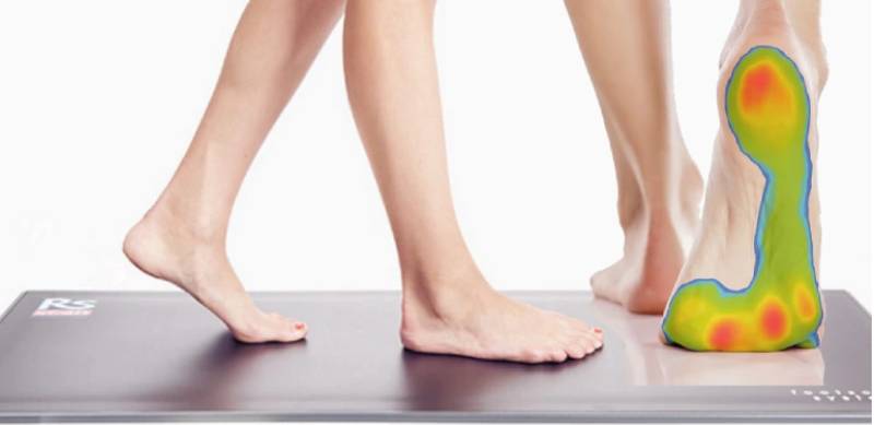 انواع اسکن کف پا