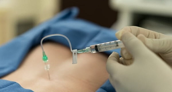 درمان کمردرد با تزریق