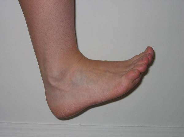 حرکت انگشت مچ پا و پا