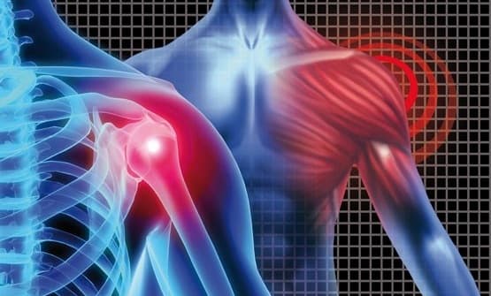 درمان شانه درد با تمرینات فیزیوتراپی و ورزش
