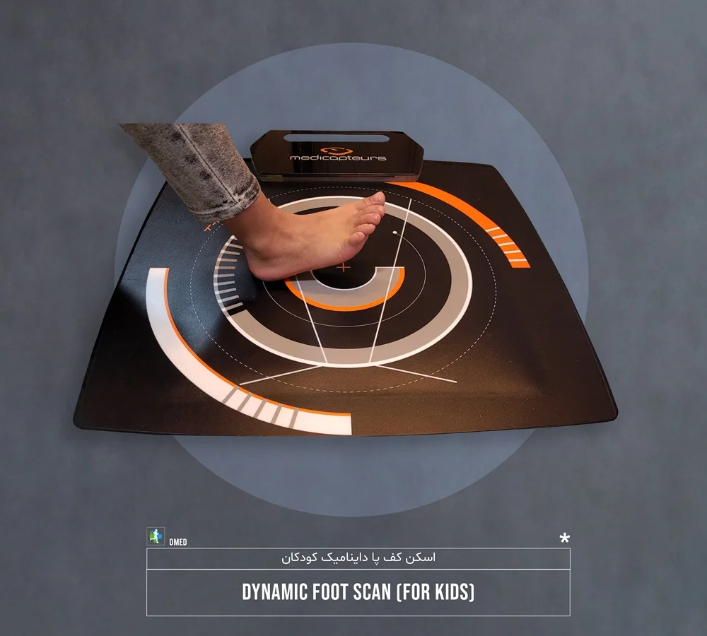 اسکن کف پا داینامیک کودکان